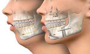 Best Oral And Maxillofacial Surgeons in Indore